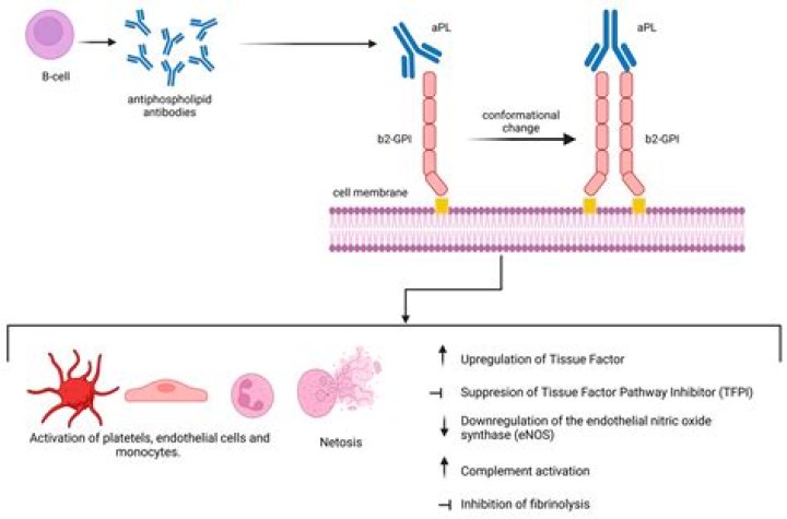 Can anticardiolipin antibodies cause infertility?