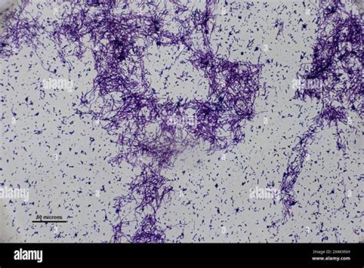 Can BV be seen under microscope?