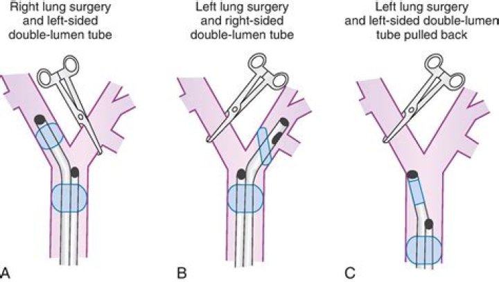 How do you isolate the left lung?
