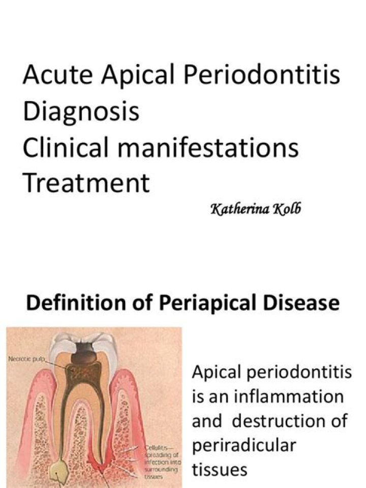 How is acute apical periodontitis treated?