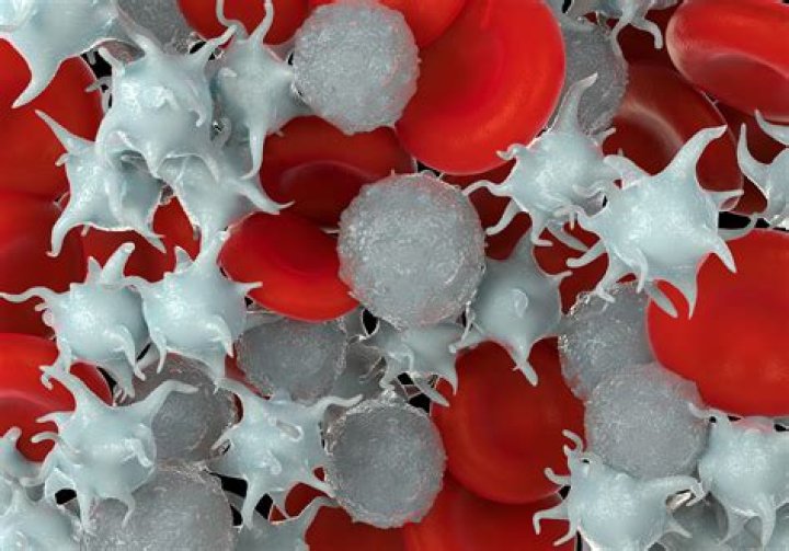 Is essential thrombocythemia a benign cancer?