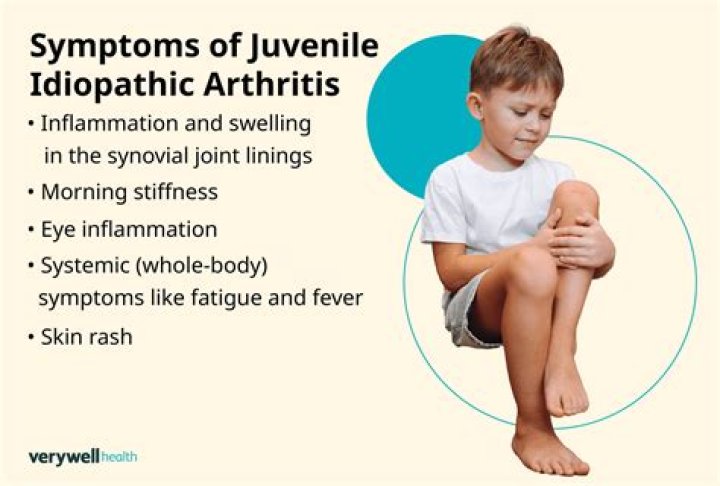 What are signs and symptoms of juvenile arthritis?