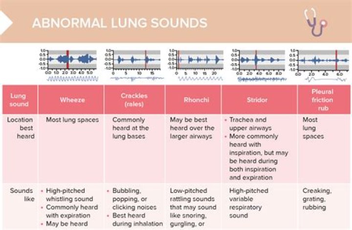 What are the common causes of abnormal engine sounds?