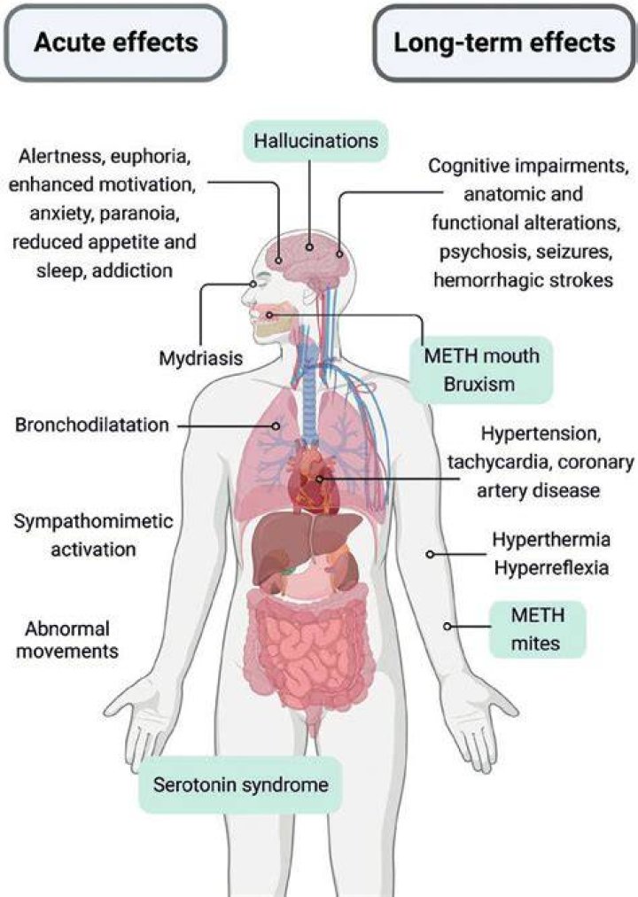 What are the long term effects of being in an induced coma?