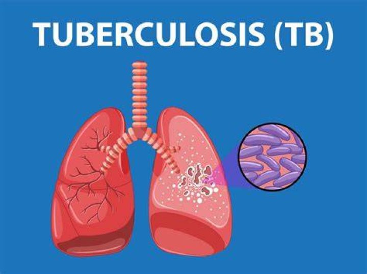 What causes Tuberculose?