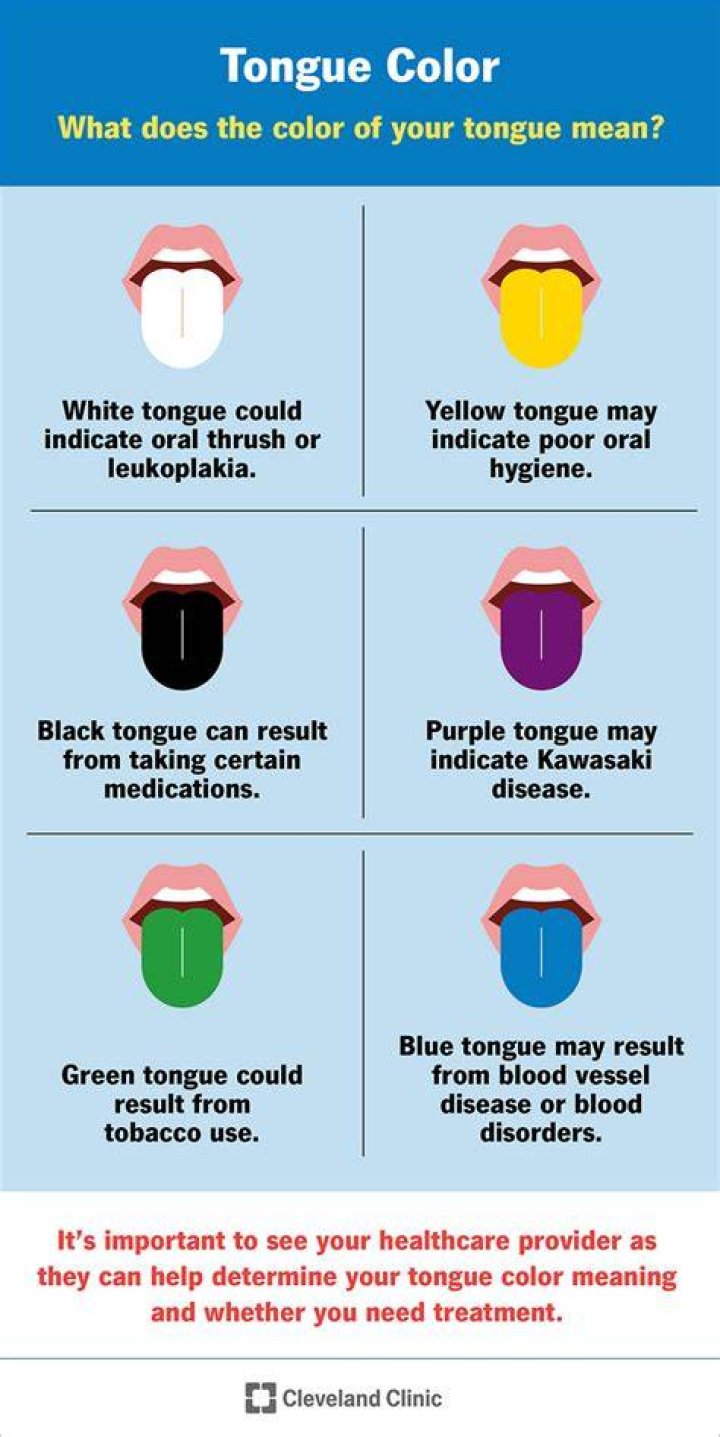 What color is your tongue when you have Covid?