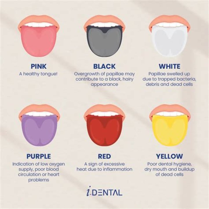 What does a constant sore tongue mean?