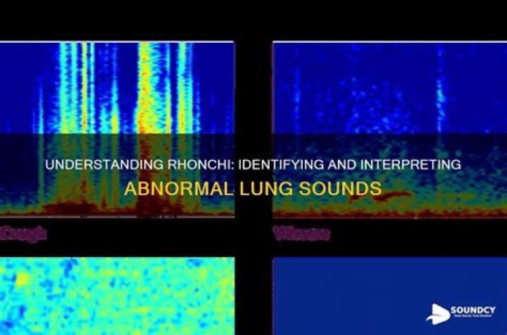 What is a Rhonchi sound?
