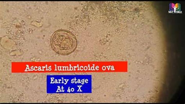 What is Ascaris lumbricoides ova?