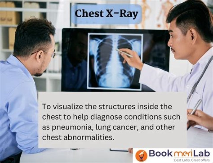 What is CXR PA view test?