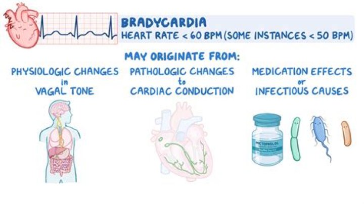 What is non reversible symptomatic bradycardia?