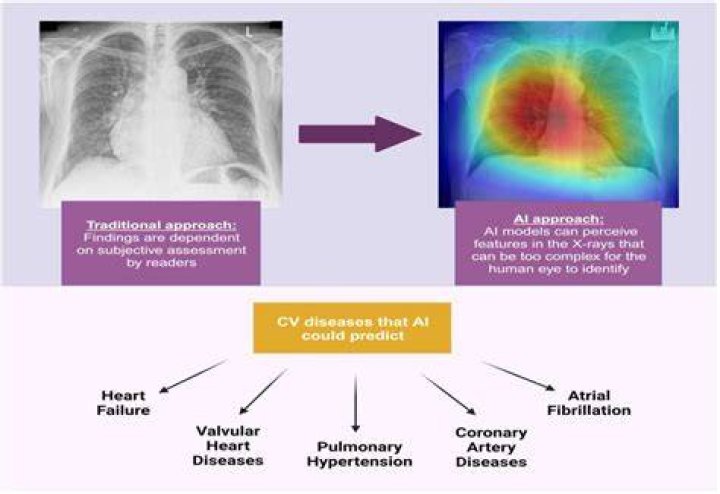 What is the best way to detect heart disease?