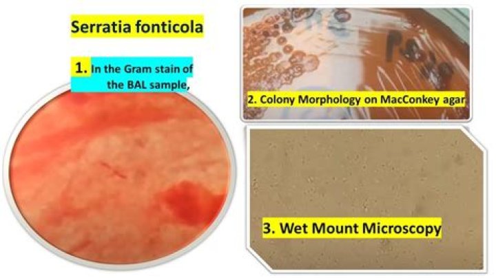 What is the morphology of Serratia marcescens?