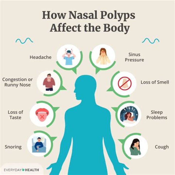 Which antihistamine is best for nasal polyps?